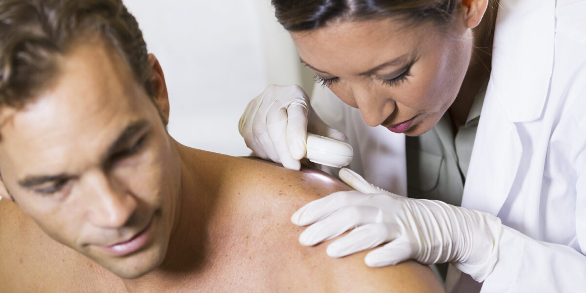 Different Types of Skin Cancer: When to Worry