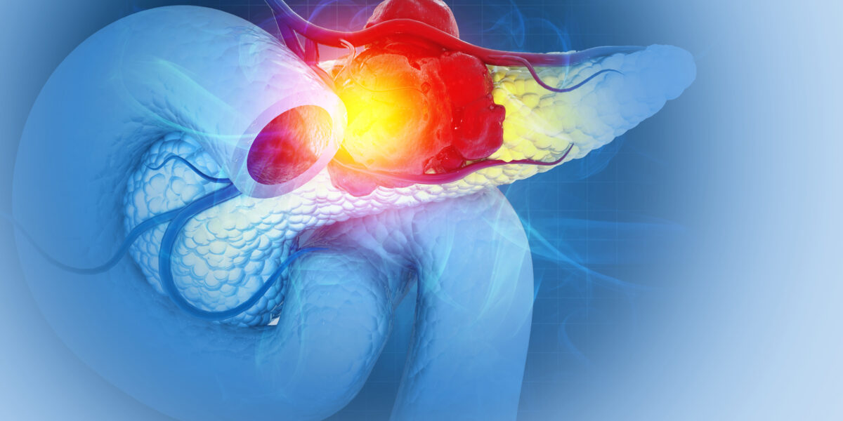 Researchers from ChristianaCare and The Wistar Institute Identify Promising New Therapeutic Target for Pancreatic Cancer