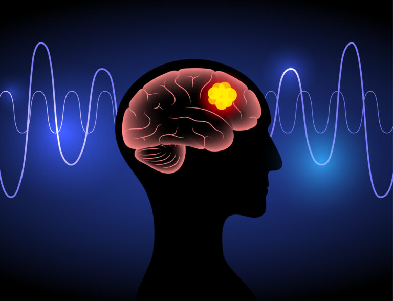 A Smarter Way to Target Brain Cancer