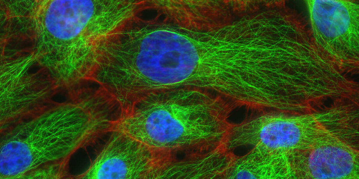 Why Breast Cancer Is Harder to Treat Than We Thought